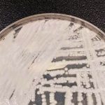 2019-04-09t220810z_1383098163_rc13eb8625f0_rtrmadp_3_usa-health-superbug